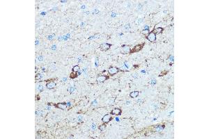 Immunohistochemistry of paraffin-embedded rat brain using NMD Rabbit pAb (ABIN6133733, ABIN6141400, ABIN6141403 and ABIN6223602) at dilution of 100 (40x lens). (GRIN1/NMDAR1 antibody  (AA 600-700))