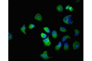 Immunofluorescent analysis of MCF-7 cells using ABIN7170144 at dilution of 1:100 and Alexa Fluor 488-congugated AffiniPure Goat Anti-Rabbit IgG(H+L) (SLC22A2 antibody  (AA 48-135))