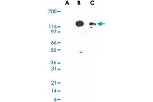 Western blot analysis of TLR3 in lysates from untransfected 293 cells (lane A), 293 cells transfected with human TLR3 cDNA (lane B), and 20 ug/lane human intestine tissue lysate (lane C). (TLR3 antibody)