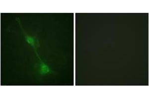 Immunofluorescence analysis of NIH-3T3 cells, using Ataxin 1 (Ab-776) Antibody. (Ataxin 1 antibody  (AA 742-791))