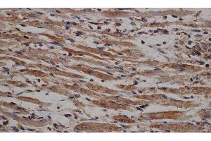 Immunohistochemistry of paraffin-embedded Mouse heart using HSPA5 Polyclonal Antibody at dilution of 1:50