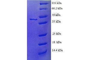 SDS-PAGE (SDS) image for FtsJ RNA Methyltransferase Homolog 1 (FTSJ1) (AA 1-329), (full length) protein (His tag) (ABIN5709539)