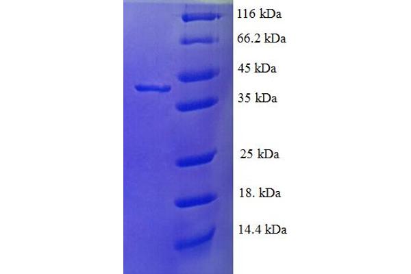 FTSJ1 Protein (AA 1-329, full length) (His tag)