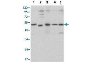 Western blot analysis using SMAD5 monoclonal antobody, clone 3H9  against HeLa (1), SK-N-SH (2), PC-12 (3), Jurkat (4), and K-562 (5) cell lysate.