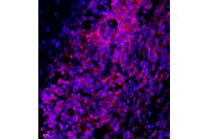 Immunofluorescence of paraffin embedded human lymph node using Thymosin (ABIN7075306) at dilution of 1:1500 (400x lens) (PTMA antibody)