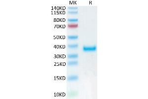 Human PRLR on Tris-Bis PAGE under reduced condition. (Prolactin Receptor Protein (PRLR) (AA 25-234) (His tag))