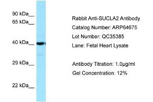 Western Blotting (WB) image for anti-Succinate-CoA Ligase, ADP-Forming, beta Subunit (SUCLA2) (C-Term) antibody (ABIN2789919)