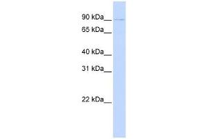 PRDM13 antibody used at 0. (PRDM13 antibody  (N-Term))