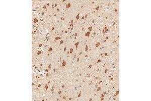 Immunohistochemical analysis of paraffin-embedded human brain tissue using (ABIN1881847 and ABIN2838812) performed on the Leica® BOND RXm. (STAT1 antibody  (C-Term))