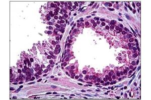 Immunohistochemistry (IHC) image for anti-Homeodomain Interacting Protein Kinase 2 (HIPK2) antibody (ABIN781914) (HIPK2 antibody)