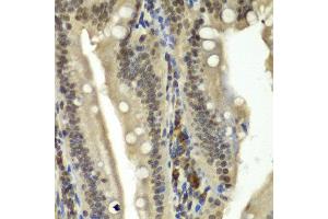 Immunohistochemistry of paraffin-embedded rat Intestine using RBBP5 antibody at dilution of 1:100 (x40 lens). (RBBP5 antibody)