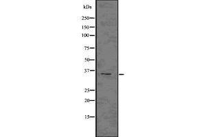 Western blot analysis NKp46 using COLO205 whole cell lysates (NCR1 antibody  (Internal Region))