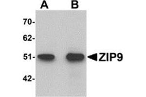 Western blot analysis of ZIP9 in HepG2 cell lysate with ZIP9 antibody at (A) 1 and (B) 2 μg/ml.