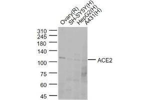 Lane 1: Rat Ovary lysates; Lane 2:SH-SY5Y cell lysates; Lane 3:HepG2 cell lysates; Lane 4: A431 cell lysates probed with ACE2 Polyclonal Antibody, Unconjugated (bs-23027R) at 1:1000 dilution and 4˚C overnight incubation. (ACE2 antibody  (AA 251-350))