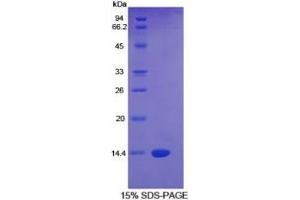 SDS-PAGE of Protein Standard from the Kit  (Highly purified E. (CTGF ELISA Kit)
