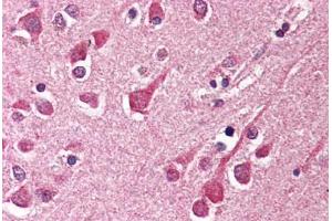 Human Brain, Cortex (formalin-fixed, paraffin-embedded) stained with KIAA1303 antibody ABIN214505 at 2. (Raptor antibody)
