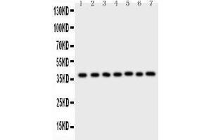 Western Blotting (WB) image for anti-Aryl Hydrocarbon Receptor Interacting Protein (AIP) (AA 91-330) antibody (ABIN3043728) (AIP antibody  (AA 91-330))