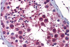 Human Testis: Formalin-Fixed, Paraffin-Embedded (FFPE) (STK38 antibody  (AA 365-466))