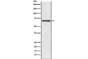 Western Blotting (WB) image for anti-Replication Protein A1, 70kDa (RPA1) antibody (ABIN7606990)