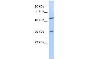 LIX1 antibody used at 1 ug/ml to detect target protein. (LIX1 antibody)