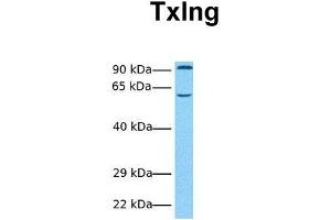 Host:  Rabbit  Target Name:  Txlng  Sample Tissue:  Human Fetal Heart  Antibody Dilution:  1. (Taxilin gamma (TXLNG) (N-Term) antibody)