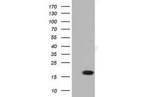 HEK293T cells were transfected with the pCMV6-ENTRY control (Left lane) or pCMV6-ENTRY TMEM80 (Right lane) cDNA for 48 hrs and lysed. (TMEM80 antibody)