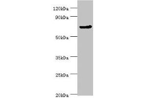 Western blot All lanes: CDC16 antibody at 4 μg/mL + Jurkat whole cell lysate Secondary Goat polyclonal to rabbit IgG at 1/10000 dilution Predicted band size: 72, 66, 61 kDa Observed band size: 72 kDa (CDC16 antibody  (AA 371-620))