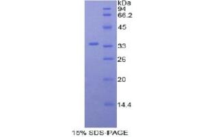 SDS-PAGE analysis of Mouse Myosin ID Protein.