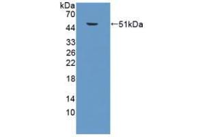 Western blot analysis of recombinant Mouse SPC. (Surfactant Protein C antibody  (AA 1-193))