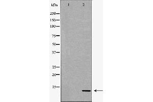 Western blot analysis of extracts of HeLa , using S100A4antibody. (s100a4 antibody  (C-Term))