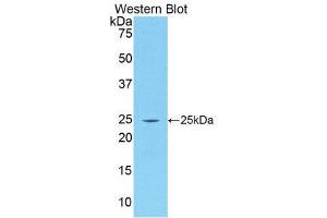 Western Blotting (WB) image for anti-Procollagen III N-Terminal Propeptide (PIIINP) (AA 24-153) antibody (ABIN1173222) (PIIINP antibody  (AA 24-153))
