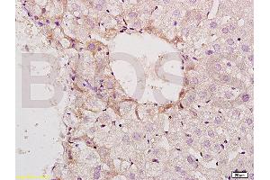 Formalin-fixed and paraffin embedded mouse small intestine tissue labeled with Anti-Phospho-GCN2 (Thr898) Polyclonal Antibody, Unconjugated (ABIN684943) at 1:200 followed by conjugation to the secondary antibody and DAB staining (GCN2 antibody  (pThr899))