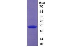 SDS-PAGE analysis of Human Collagen Type XVIII Protein. (COL18 Protein)