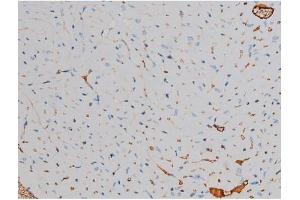Immunohistochemistry (IHC) image for anti-Ribosomal Protein S6 Kinase, 70kDa, Polypeptide 1 (RPS6KB1) (pSer371) antibody (ABIN6256305)