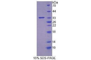 SDS-PAGE (SDS) image for Oxysterol Binding Protein (OSBP) (AA 546-807) protein (His tag) (ABIN6239189) (OSBP Protein (AA 546-807) (His tag))