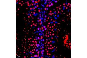 Immunofluorescence (Paraffin-embedded Sections) (IF (p)) image for anti-RB-Associated KRAB Zinc Finger (RBAK) antibody (ABIN7075383)