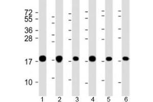 Western blot testing of human 1) A549, 2) HeLa, 3) HepG2, 4) U-2OS, 5) Jurkat and 6) placenta lysate with COMMD1 antibody at 1:2000. (COMMD1 antibody  (AA 4-33))