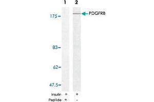 Western blot analysis of extracts from 293 cells using PDGFRB polyclonal antibody . (PDGFRB antibody)