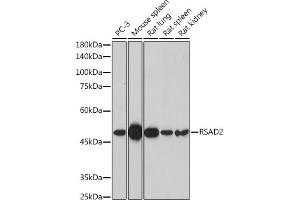 Western blot analysis of extracts of various cell lines, using RS antibody (ABIN7269832) at 1:1000 dilution. (RSAD2 antibody  (AA 42-361))
