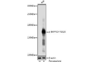 Western blot analysis of extracts of Raji cells, using Phospho-SHIP1-Y1020 antibody (ABIN6135243, ABIN6136110, ABIN6136111 and ABIN6225677) at 1:1000 dilution. (INPP5D antibody  (pTyr1020))