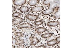 Immunohistochemical staining of human stomach with ZNF384 polyclonal antibody  shows strong nuclear positivity in glandular cells at 1:50-1:200 dilution.