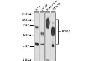 Western blot analysis of extracts of various cell lines, using  antibody (ABIN3022783, ABIN3022784, ABIN3022785 and ABIN6219227) at 1:500 dilution. (beta 2 Adrenergic Receptor antibody  (AA 334-413))