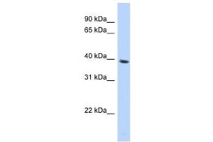 SPON2 antibody used at 1 ug/ml to detect target protein. (SPON2 antibody  (N-Term))