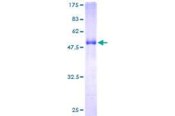 EPDR1 Protein (AA 38-224) (GST tag)