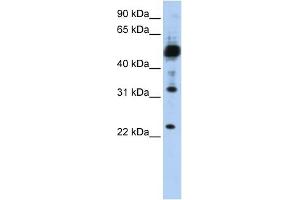 TMEM38B antibody used at 1 ug/ml to detect target protein. (TMEM38B antibody  (C-Term))