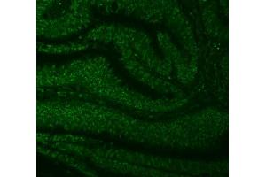 IF analysis of SNRNP27 using anti-SNRNP27 antibody (ABIN7599614). (SNRNP27 antibody  (AA 100-155))