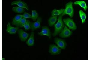 Immunofluorescence staining of A549 cells with ABIN7150750 at 1:100, counter-stained with DAPI. (DUSP15 antibody  (AA 1-295))