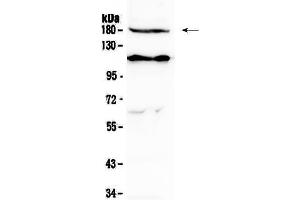 Western blot analysis of VEGF Receptor 2  using anti-VEGF Receptor 2  antibody . (VEGFR2/CD309 antibody  (AA 20-242))