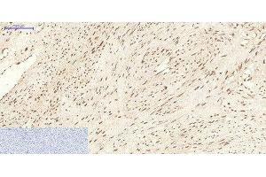 Immunohistochemistry of paraffin-embedded Human uterus tissue using CBX5 Monoclonal Antibody at dilution of 1:200. (CBX5 antibody)