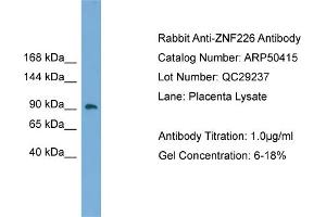 WB Suggested Anti-ZNF226  Antibody Titration: 0.